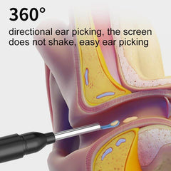 Smart HD Ear Cleaner with Camera – Wireless Otoscope Wax Removal Tool for Baby & Adults (iOS & Android Compatible - Gardino