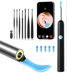 Smart HD Ear Cleaner with Camera – Wireless Otoscope Wax Removal Tool for Baby & Adults (iOS & Android Compatible - Gardino