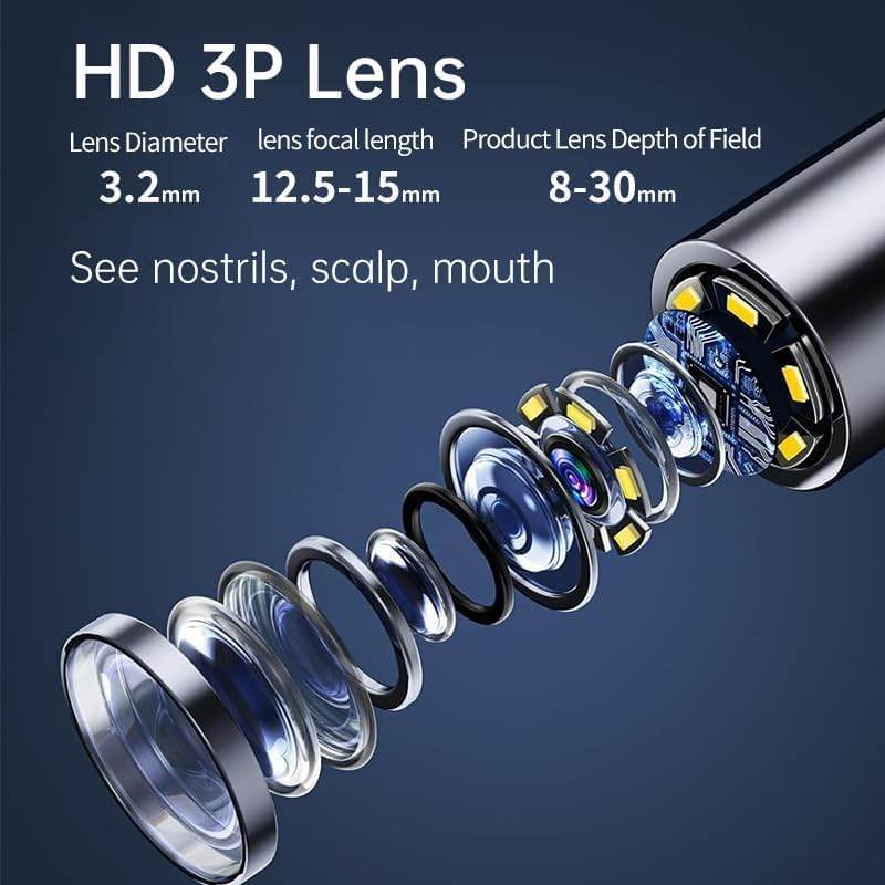 Smart HD Ear Cleaner with Camera – Wireless Otoscope Wax Removal Tool for Baby & Adults (iOS & Android Compatible - Gardino